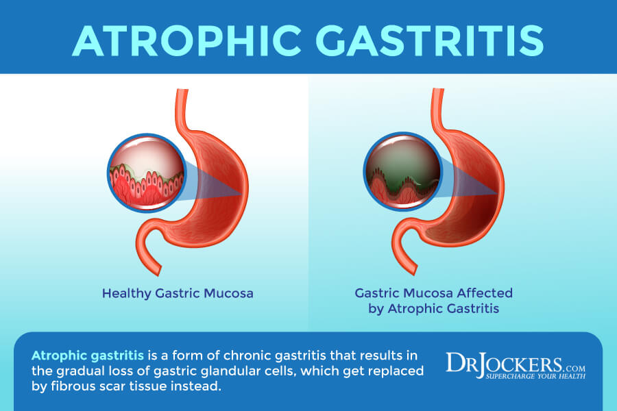 gastritis