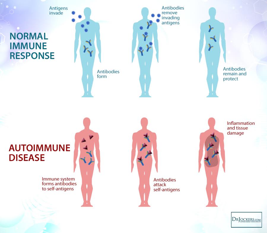 autoimmune