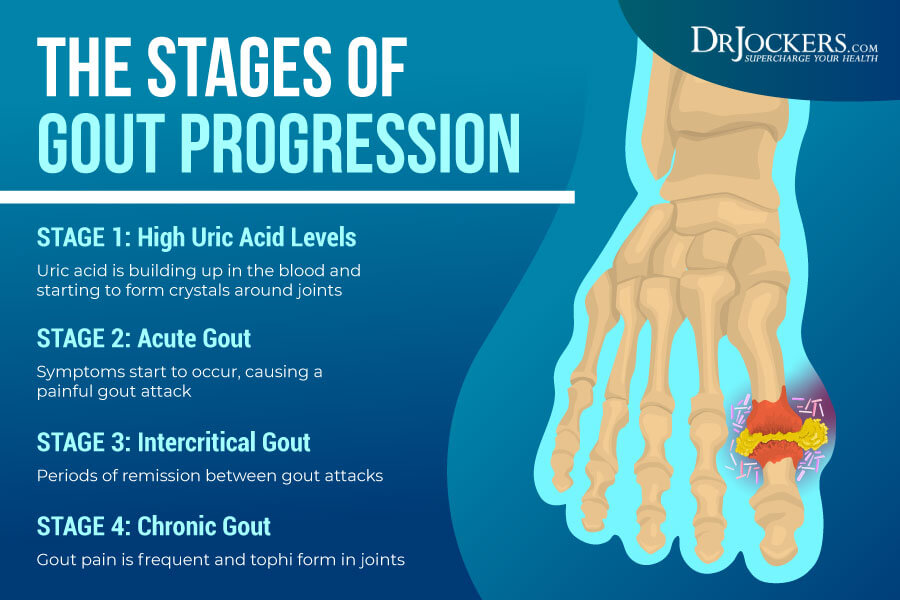 uric acid