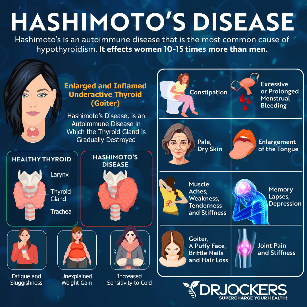 Hashimoto's Disease