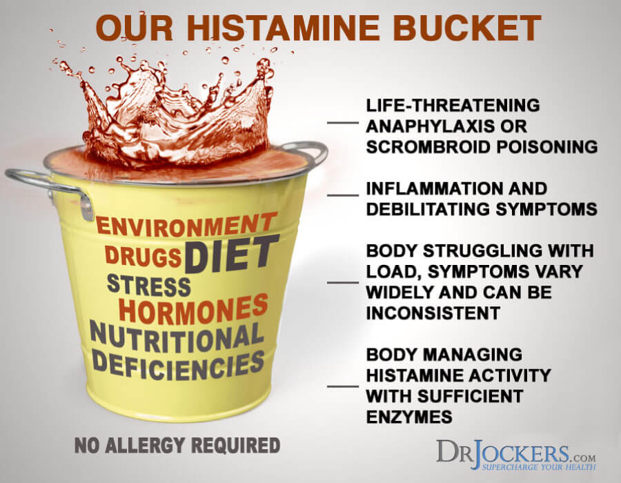 histamine intolerance