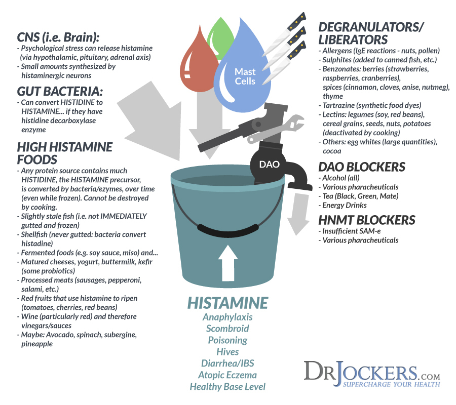 histamine intolerance