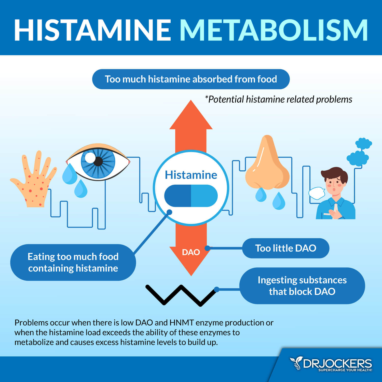 histamine intolerance