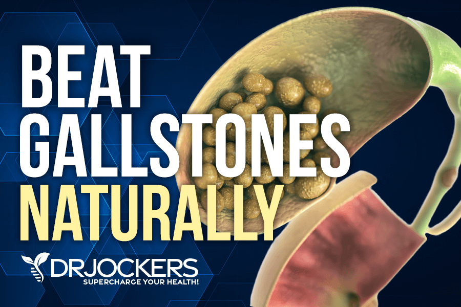 gallstones